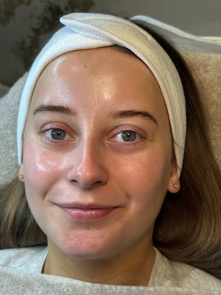 Client smiling with fresh, dewy skin post-treatment