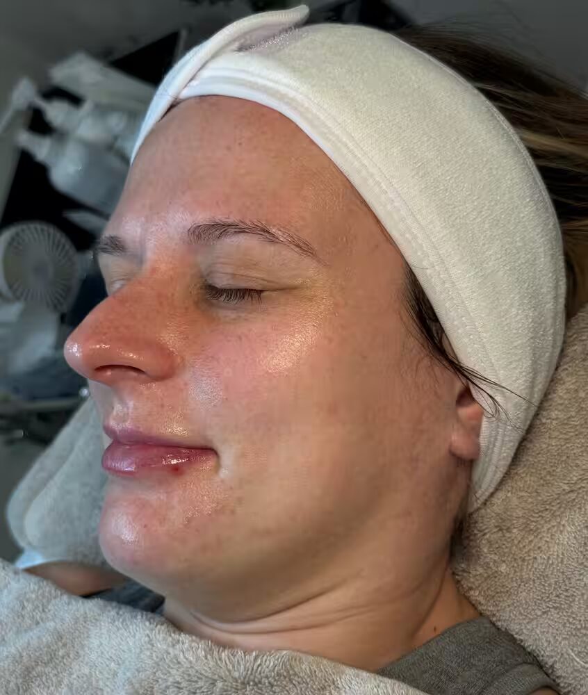 Smooth, hydrated skin after a signature facial