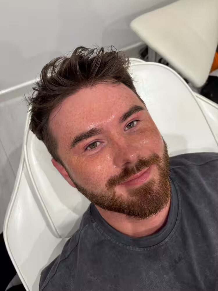 Client after a men's deep cleanse facial at Skin by Emma